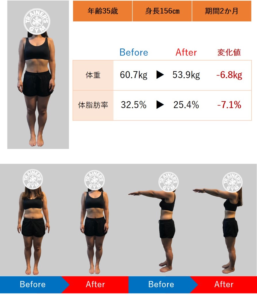 35歳女性 Before / After ビフォーアフター