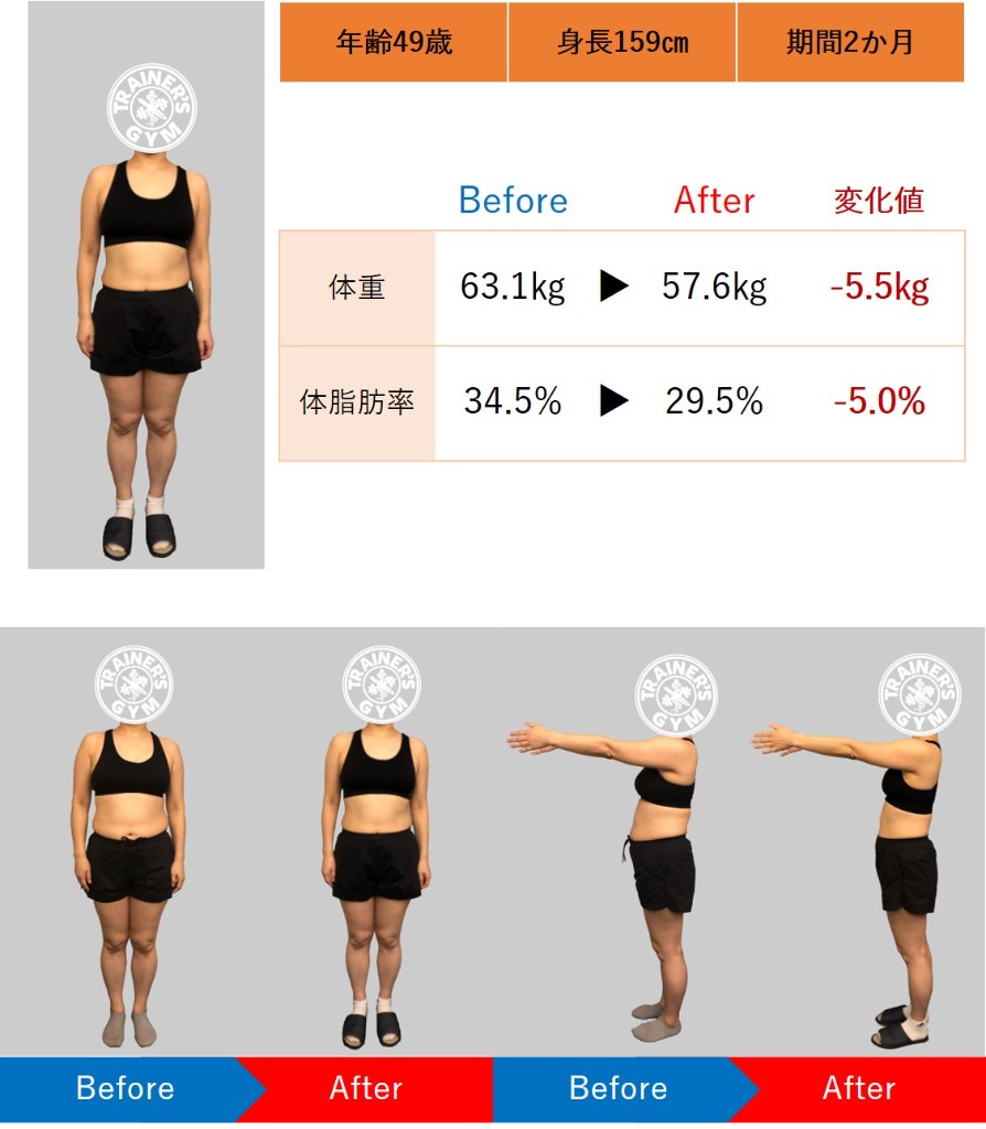 49歳女性 Before / After ビフォーアフター